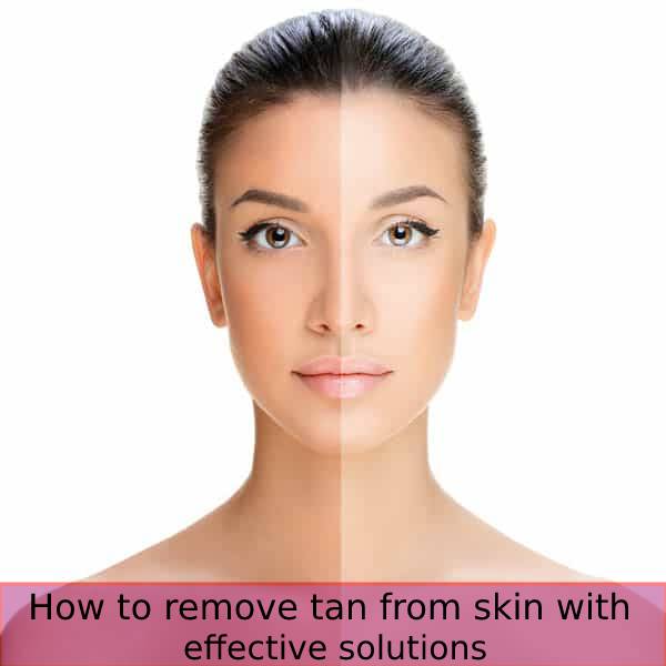 How to remove tan from skin with these effective solutions